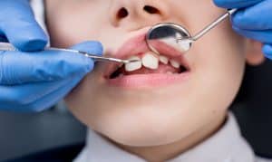 dentist examines the teeth of the patient child