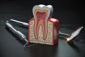 Tooth model cross section with dental tools