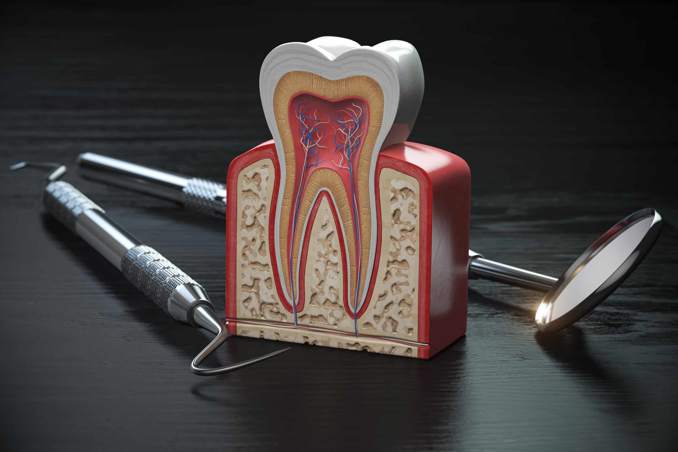 Tooth model cross section with dental tools